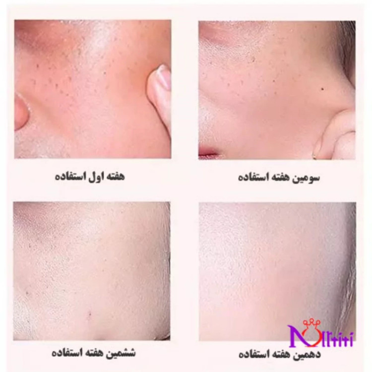 تونر پاک کننده آرایش،آبرسان و مرطوب کننده،تونر پرتقال خونی ایمیجز IMAGES، اَصل (ارسال فوری).