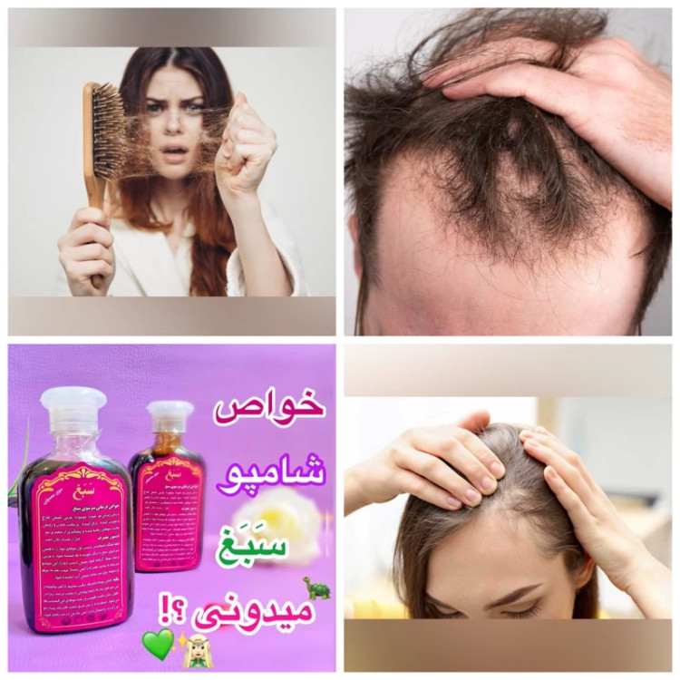 شامپو ضد ریزش سبغ،شامپو گیاهی و رفع ریزش سبغ،مناسب موهای چرب، اَصل (ارسال فوری).